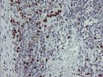 PADI4 Antibody in Immunohistochemistry (Paraffin) (IHC (P))