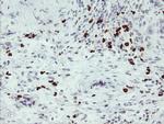 PADI4 Antibody in Immunohistochemistry (Paraffin) (IHC (P))