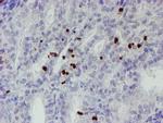 PADI4 Antibody in Immunohistochemistry (Paraffin) (IHC (P))