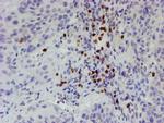 PADI4 Antibody in Immunohistochemistry (Paraffin) (IHC (P))