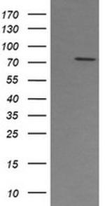 PADI4 Antibody in Western Blot (WB)