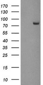 PADI4 Antibody in Western Blot (WB)