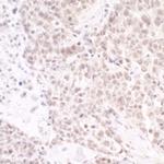 PAF49 Antibody in Immunohistochemistry (IHC)