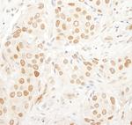 PAF49 Antibody in Immunohistochemistry (IHC)