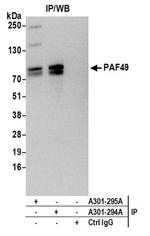 PAF49 Antibody in Immunoprecipitation (IP)