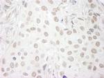 PAF49 Antibody in Immunohistochemistry (IHC)