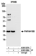 PAFAH1B3 Antibody in Western Blot (WB)