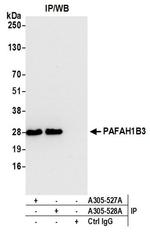 PAFAH1B3 Antibody in Western Blot (WB)