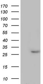 PAFAH1B3 Antibody in Western Blot (WB)