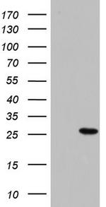 PAFAH1B3 Antibody in Western Blot (WB)