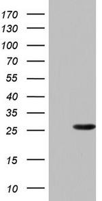 PAFAH1B3 Antibody in Western Blot (WB)