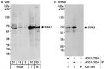 PAK1 Antibody in Western Blot (WB)