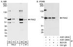 PAK2 Antibody in Western Blot (WB)