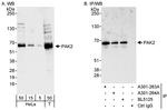 PAK2 Antibody in Western Blot (WB)