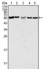 PAK2 Antibody in Western Blot (WB)