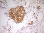 PAK4 Antibody in Immunohistochemistry (Paraffin) (IHC (P))