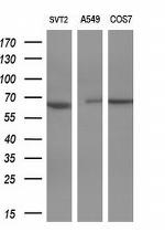 PAK4 Antibody in Western Blot (WB)