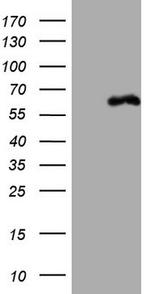 PAK4 Antibody in Western Blot (WB)