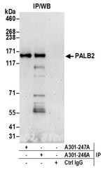 PALB2 Antibody in Western Blot (WB)