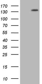 PALB2 Antibody in Western Blot (WB)