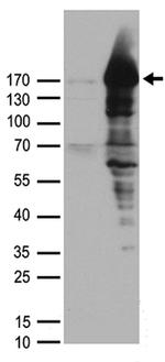 PALB2 Antibody in Western Blot (WB)