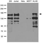 PALB2 Antibody in Western Blot (WB)