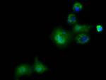 PANK2 Antibody in Immunocytochemistry (ICC/IF)