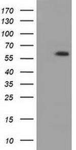 PANK2 Antibody in Western Blot (WB)