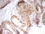 PAPSS2 Antibody in Immunohistochemistry (Paraffin) (IHC (P))