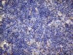 PAPSS2 Antibody in Immunohistochemistry (Paraffin) (IHC (P))