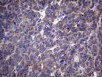 PAPSS2 Antibody in Immunohistochemistry (Paraffin) (IHC (P))