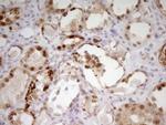 PAPSS2 Antibody in Immunohistochemistry (Paraffin) (IHC (P))