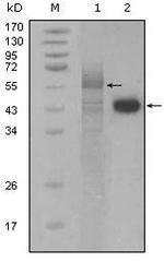 PAR4 Antibody in Western Blot (WB)