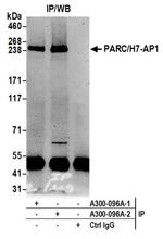 PARC/H7-AP1 Antibody in Western Blot (WB)