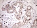 PARG Antibody in Immunohistochemistry (Paraffin) (IHC (P))