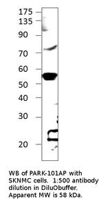 Parkin Antibody in Western Blot (WB)