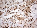 PARN Antibody in Immunohistochemistry (Paraffin) (IHC (P))