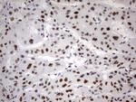 PARN Antibody in Immunohistochemistry (Paraffin) (IHC (P))