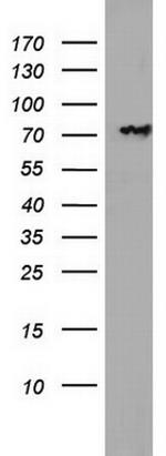 PARN Antibody in Western Blot (WB)