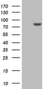 PARN Antibody in Western Blot (WB)