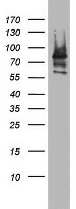 PARN Antibody in Western Blot (WB)