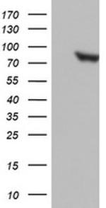 PARN Antibody in Western Blot (WB)