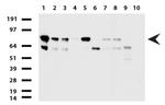 PARN Antibody in Western Blot (WB)