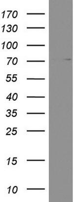 PARN Antibody in Western Blot (WB)