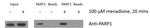 PARP1 Antibody in Immunoprecipitation (IP)