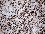 PARP1 Antibody in Immunohistochemistry (Paraffin) (IHC (P))