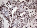 PARP1 Antibody in Immunohistochemistry (Paraffin) (IHC (P))