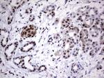 PARP1 Antibody in Immunohistochemistry (Paraffin) (IHC (P))