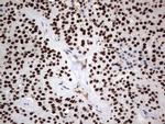 PARP1 Antibody in Immunohistochemistry (Paraffin) (IHC (P))