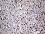 PARP1 Antibody in Immunohistochemistry (Paraffin) (IHC (P))